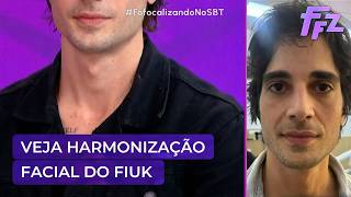 Confira AGORA o resultado da harmonização facial do Fiuk | Fofocalizando 29/09/26