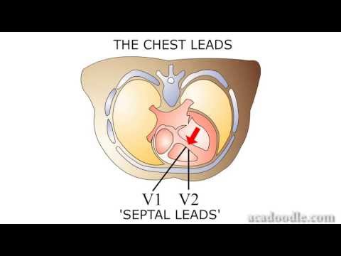 ECG Interpretation - ECG Lead Perspectives