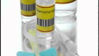 Understanding Esophageal Cancer, Part IV:  Treatment