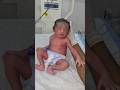 Moro reflex in Newborn 😱#shorts #newborn #youtubeshorts #viralshort #babyhealth #babycare #nicucare