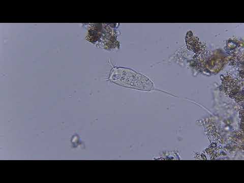 Stalked sessile filter-feeding ciliate (Sessilida)