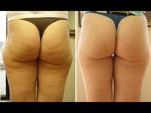 Que produtos restauram uma potência