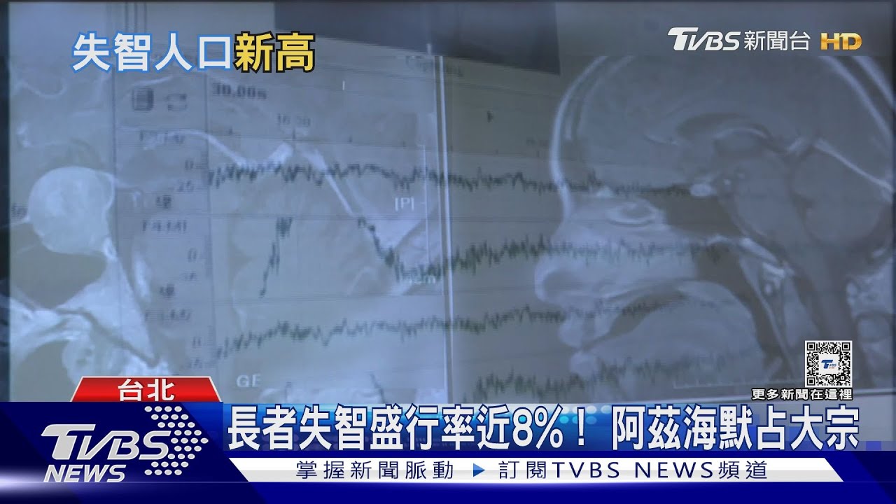全國長者失智盛行率近8%！女性多於男性　阿茲海默占大宗