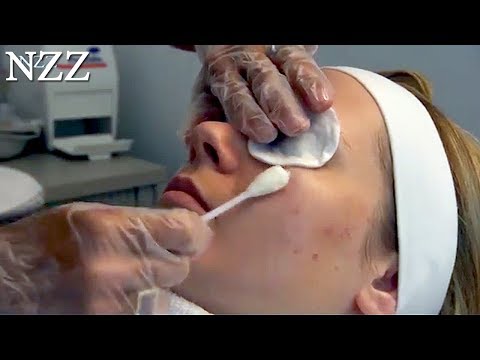 Zäh und sensibel: Die Haut - Dokumentation von NZZ Format (2008)