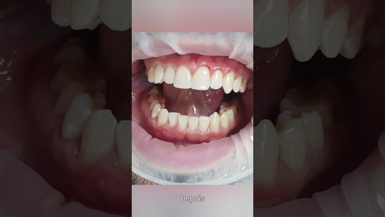 Saint Clair Barbosa Netto-24