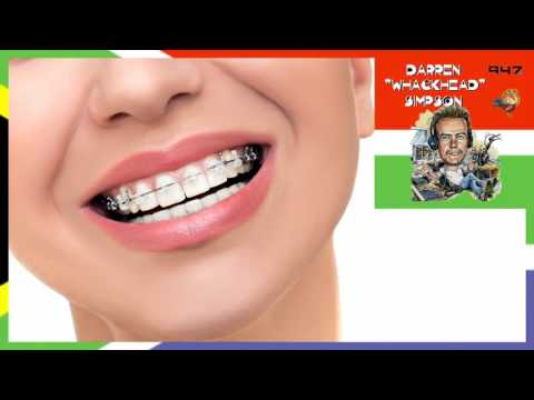 Whackhead Simpson - Used Braces Surprise