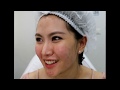 ร้อยไหม หน้าเรียว