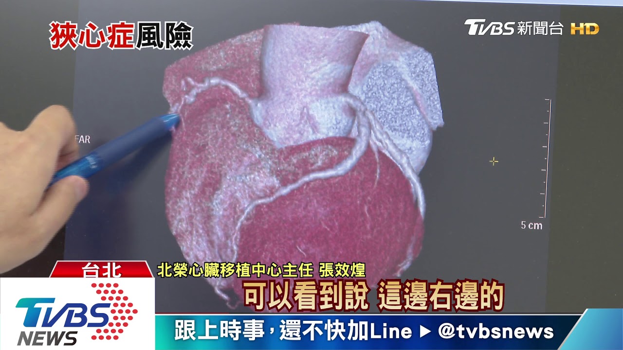 持續頭暈 站不穩!小心可怕最危險慢性疾病找上你!