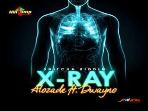 Alozade Feat Dwayno -  X-Ray ( Official Audio )