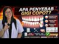 Apa Penyebab Gigi Copot Atau Tanggal