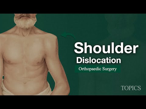 Shoulder Dislocation