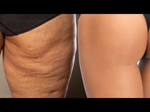Pagkain para sa pagbaba ng timbang sa home video na kapaligiran Dilaw na bath Zalmanova slimming