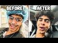 I Got My Wisdom Teeth Removed