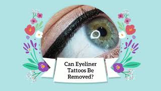 CAN EYELINER TATTOOS BE REMOVED?