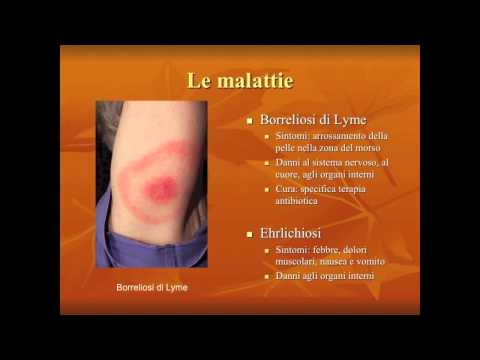 Nazionale significa da posti di pigmentary su una faccia Capelli scuri con lentiggini