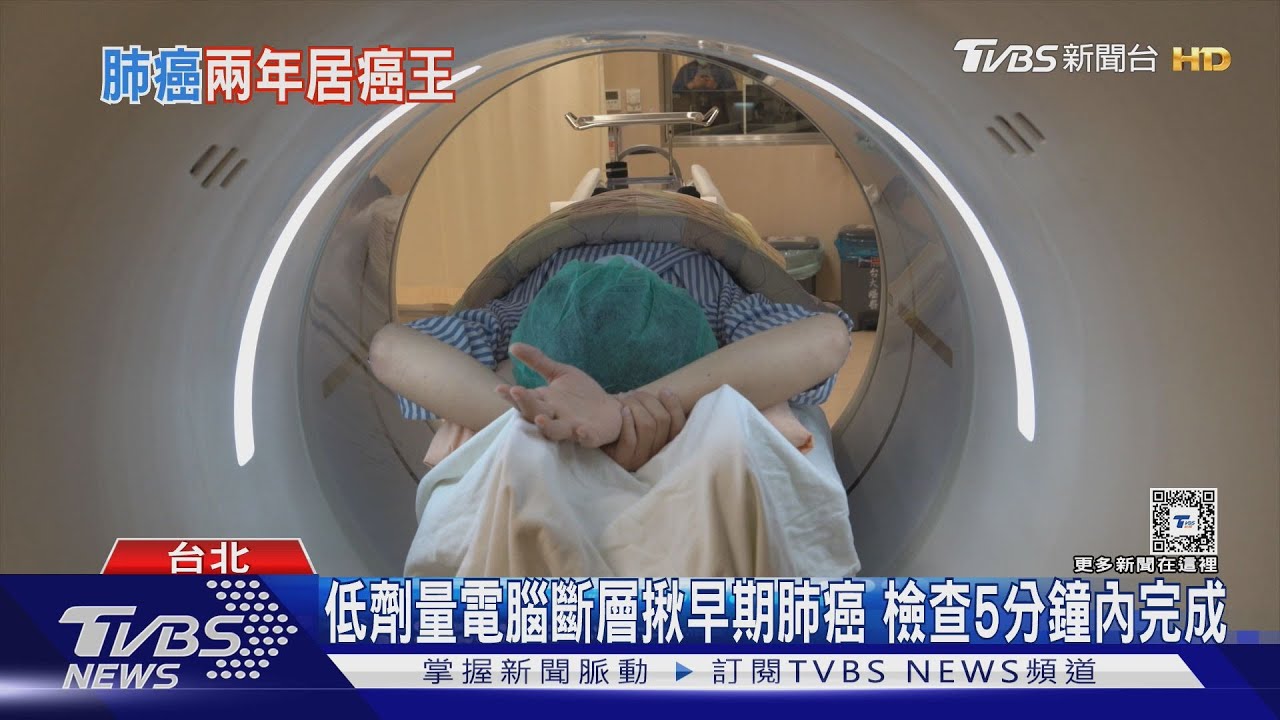 不吸菸肺癌患者逐年增加 研究顯示與空汙及吃「這個」有關 台灣肺癌防治評比「藥物」輸日韓