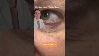 Eyelid twitching, aka myokemia #optometrist #eyetwitching #eyehealth #eyes #twitch #optician