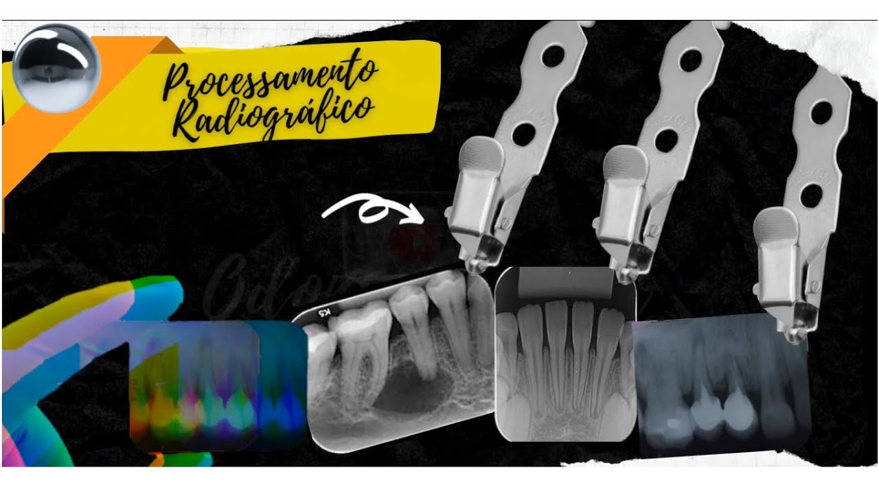 Processamento Radiográfico ("Revelação")