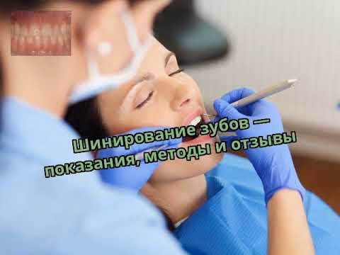 Шинирование зубов — показания, методы и отзывы
