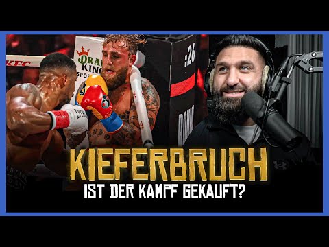 IST DER KAMPF GEKAUFT❓😱 KIEFERBRUCH + KEINE ZÄHNE MEHR😱| SINAN-G STREAM HIGHLIGHTS