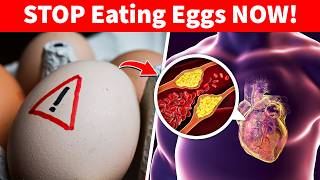 AVOID Eggs If You Have THESE Health Problems!
