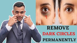 Remove Dark circles Permanently( Beauty Tips) - Dr Vivek Joshi