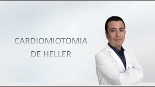 Cirugia para Acalasia