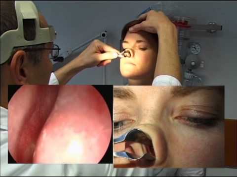 Medizin verstehen: Der HNO Status