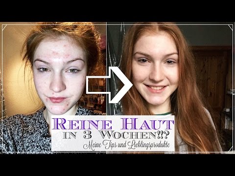 Eksoderila die Tropfen die Rezensionen Gribok die Beine mit dem Eiterfluss