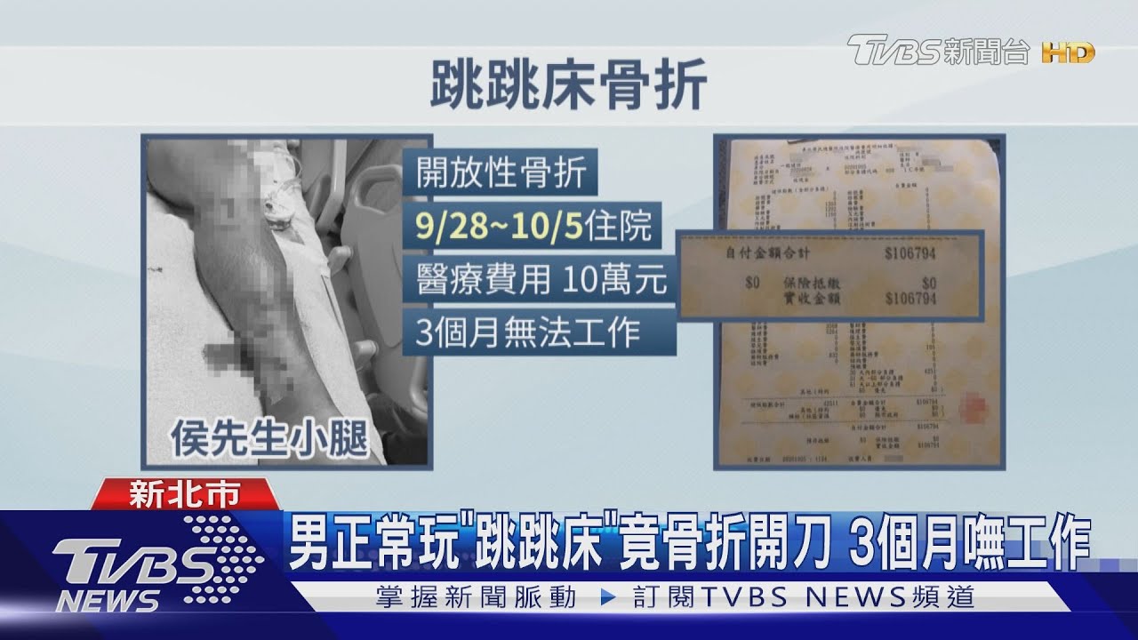 男正常玩「跳跳床」竟骨折開刀 3個月嘸工作