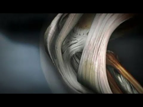 WDR / Quarks & Co: Faszien - was das Bindegewebe leistet