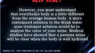 Does Drinking Water Help Acne - Get The Truth Straight Here