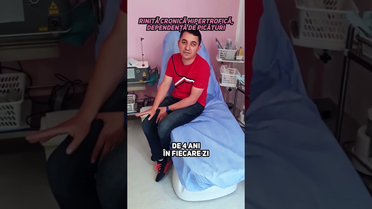 RINITĂ MEDICAMENTOASĂ, DEPENDENȚA DE PICATURI DE 15 ANI