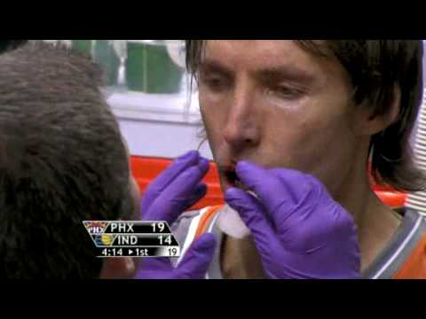 Steve Nash injury vs Indiana Pacers HD