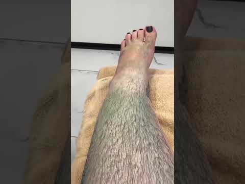 full leg waxing #waxing #bodywax #waxingstrips #hairremovalmethods