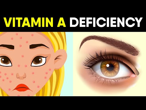 7 Hidden Signs of Vitamin A Deficiency You Should Not Ignore