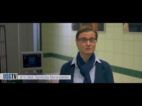 Szkolenie: "Doppler żył i tętnic kończyn dolnych"