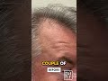 92.9's Mike Bell Has Hair AGAIN!