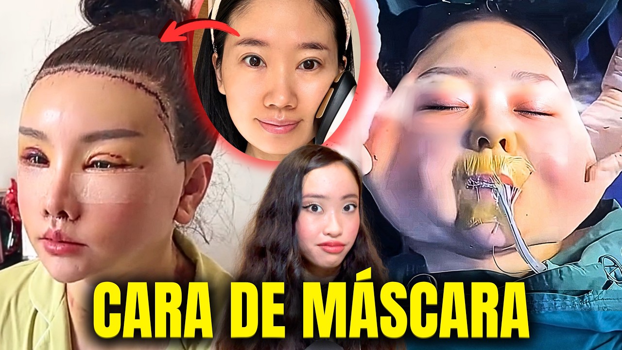 Pagaron miles por REJUVENECER… terminaron con la cara ESTIRADA COMO GOMA