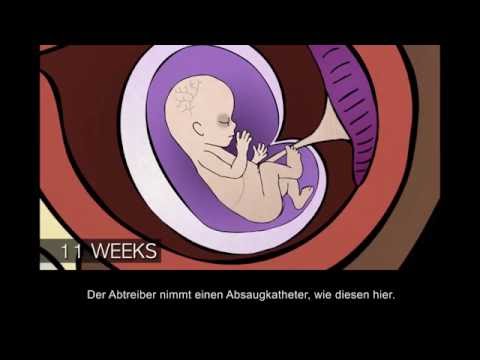 Medikamente gegen Juckreiz Diabetes Typ-2-Diabetes um 10 mb