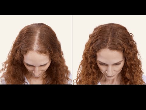 Fine or thin hair? The Scalp Foundation ... Transforming self-consciousness into self-confidence!