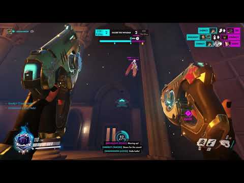 big brain tracer montage #1