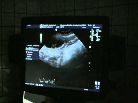 ultrasonic at our kooikerhondje - kal-b-01