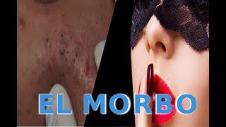 EL MORBO | H3TV |