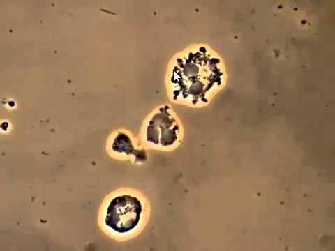 Bacteria attacking White Blood Cells