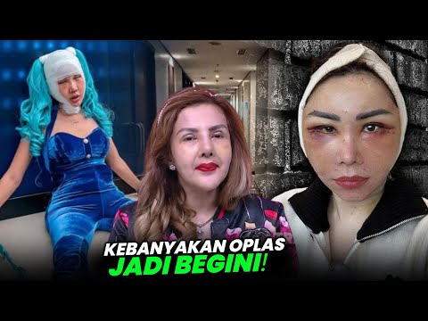 6 Artis yang Lakukan Operasi Plastik Lebih Dari Tiga Kali