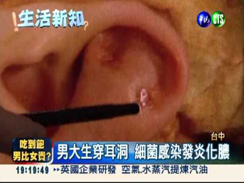 男大生穿耳洞 軟骨遭細菌吃光