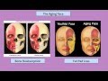 Fillers The Magic Wand For Restoring Your Natural Beauty