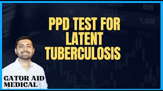 They changed tuberculosis! PPD Testing + LTBI for USMLE