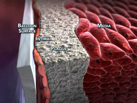 POBA   slide 10 2011